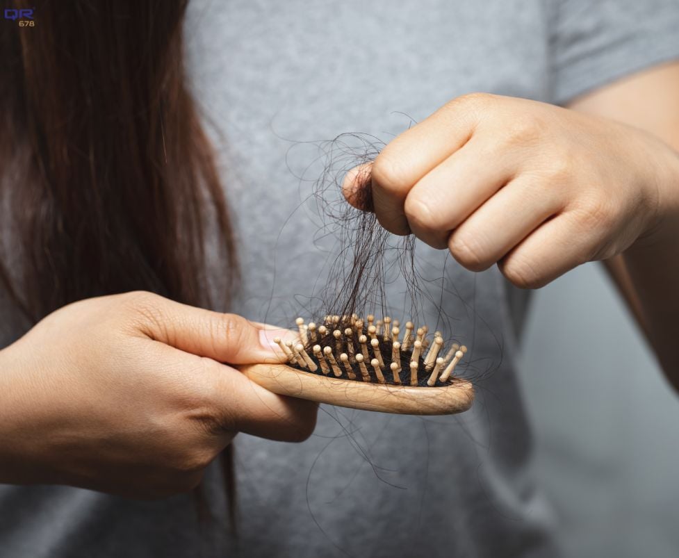 How to Stop Hair Loss Due to Thyroid Problems?